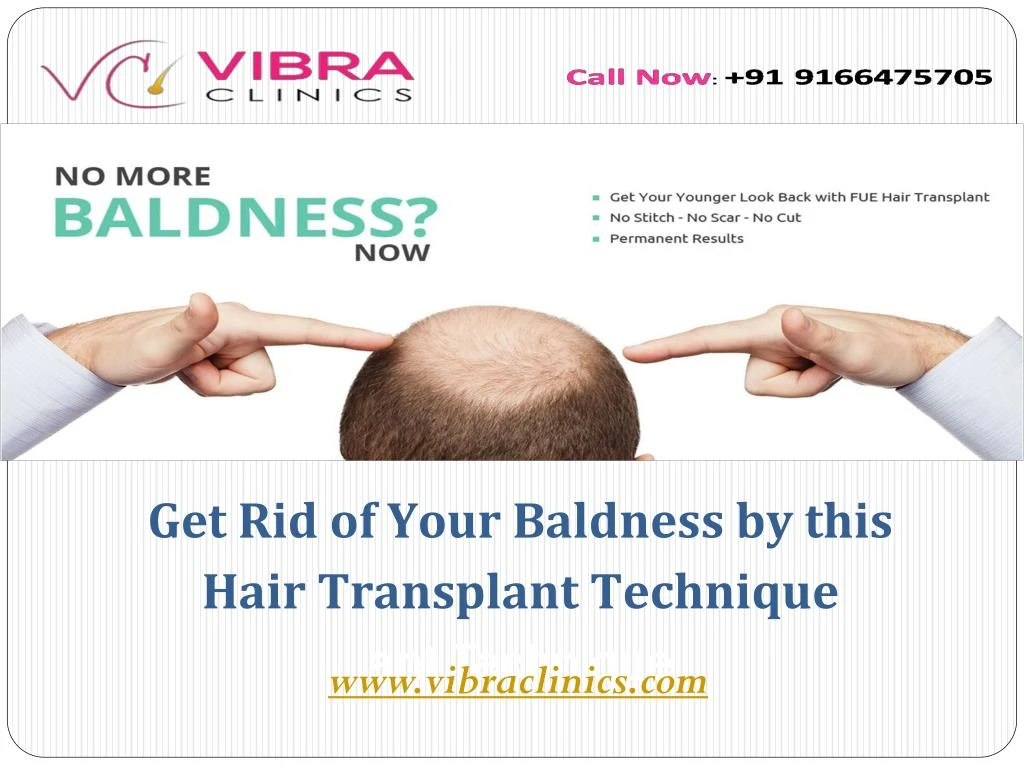 get rid of your baldness by this hair transplant technique ant technique