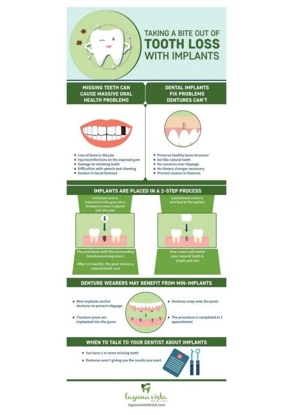 Dental Implants - The smart solution for tooth loss