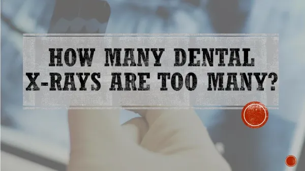 How Many Dental X-rays are Too Many?