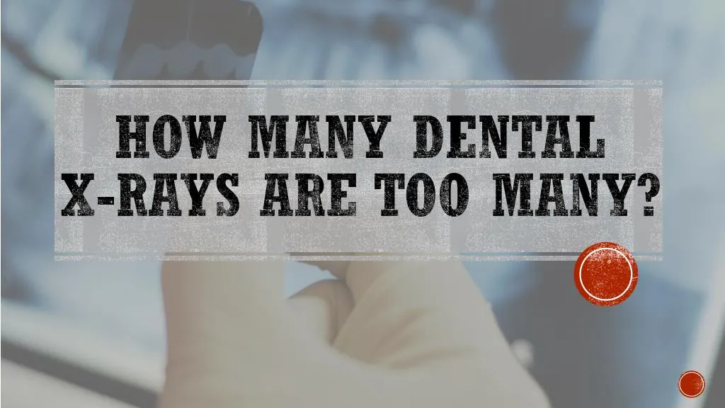 how many dental x rays are too many