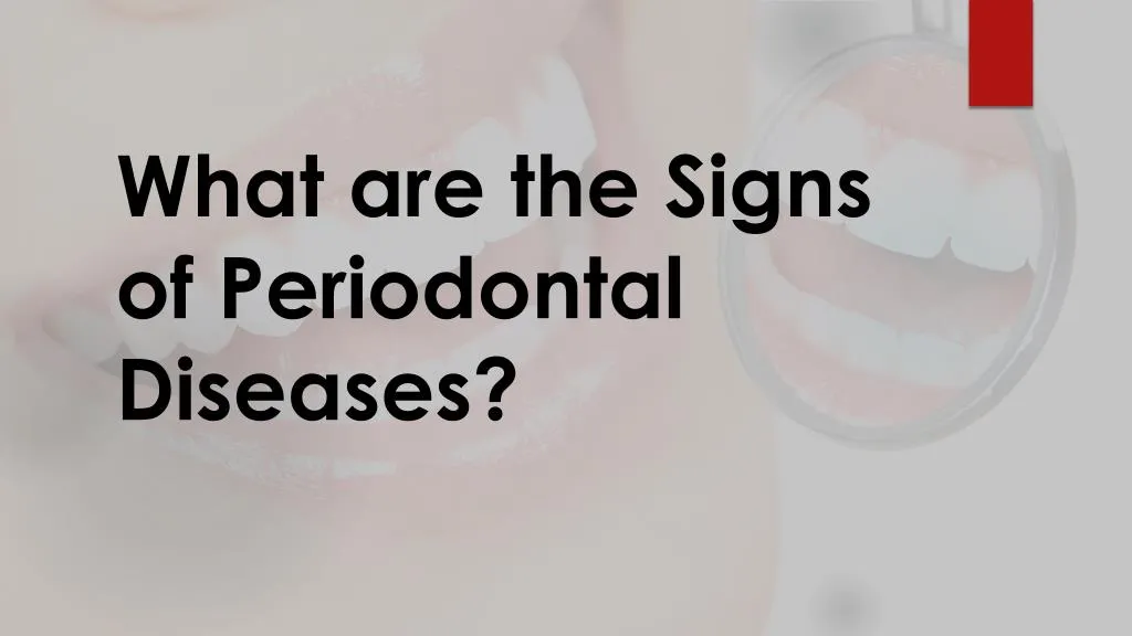 what are the signs of periodontal diseases