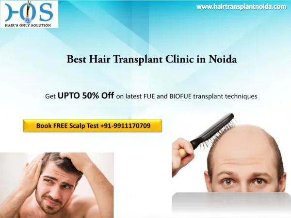 Looking for Hair Loss Treatment Clinic in Delhi or Noida Contact HOS 9911170709