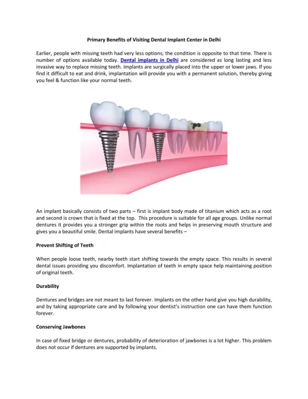 Primary Benefits of Visiting Dental Implant Center in Delhi