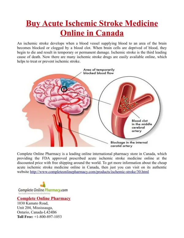 Buy Acute Ischemic Stroke Medicine Online in Canada