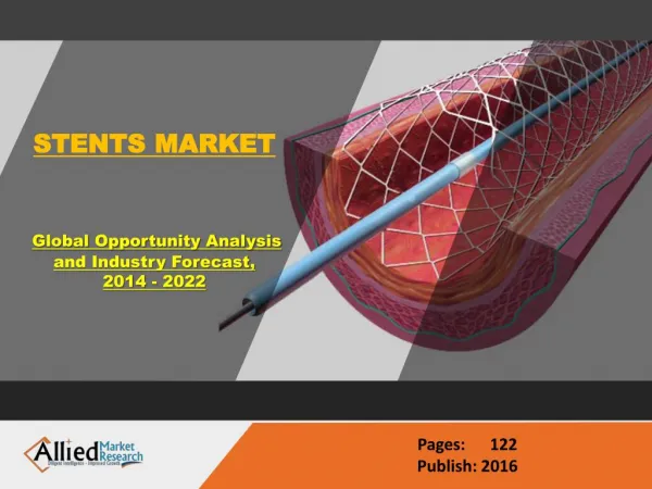Stent Market Share & Research Analysis 2022