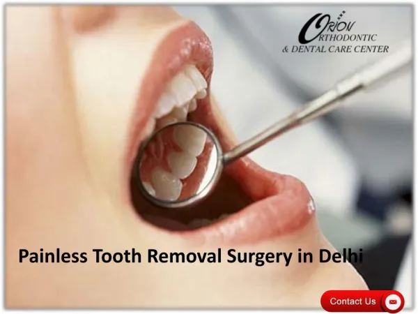 Painless Tooth Removal Surgery in Delhi