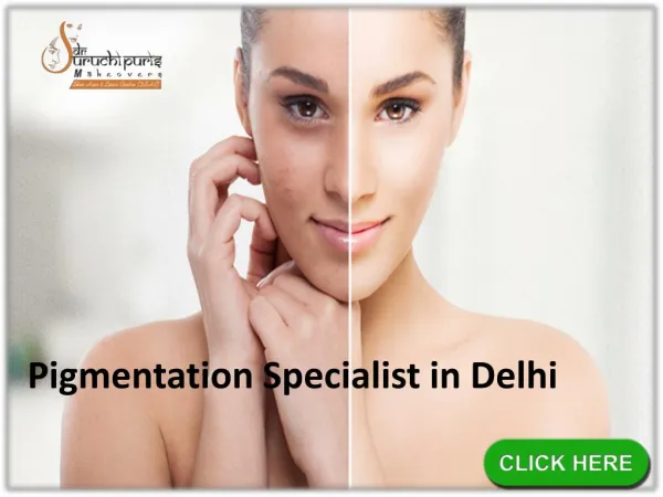 Pigmentation Specialist in Delhi
