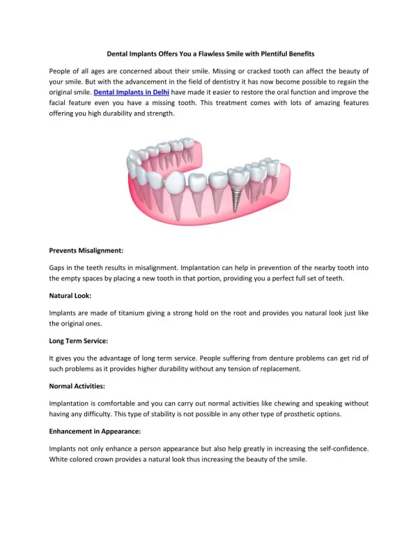 Dental Implants Offers You a Flawless Smile with Plentiful Benefits