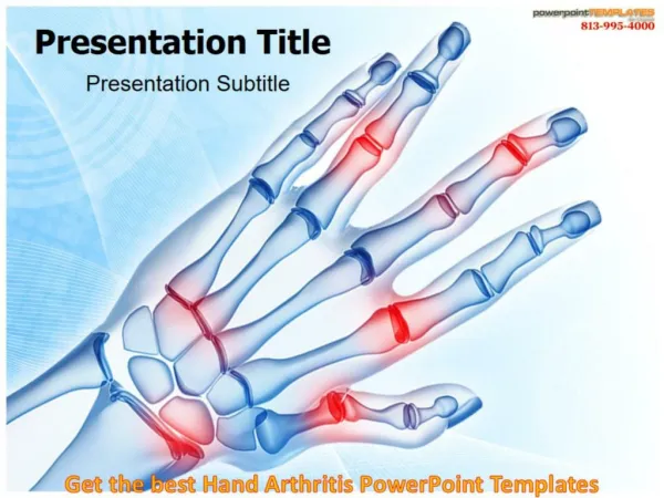 Get the best Hand Arthritis PowerPoint Templates