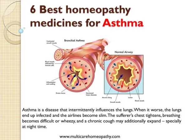 Best 6 homeopathy medicines for asthma
