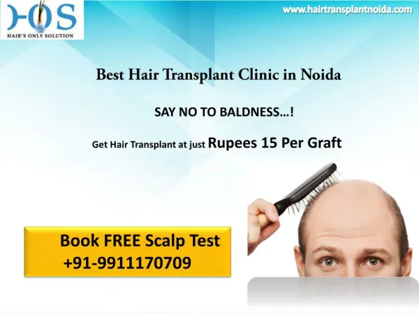Low Cost Hair Transplant at Rupees 15 per graft in Delhi NCR Contact HOS 9911170709