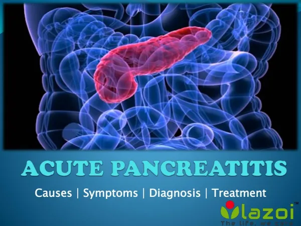 Acute pancreatitis causes symptoms and treatments