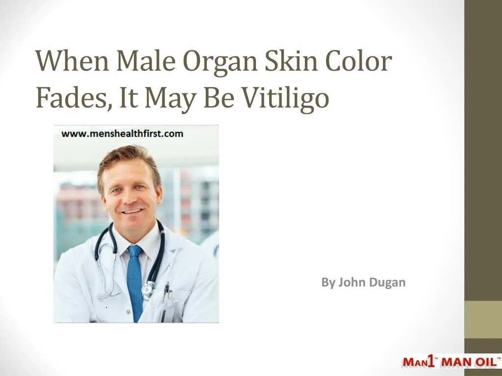 when male organ skin color fades it may be vitiligo