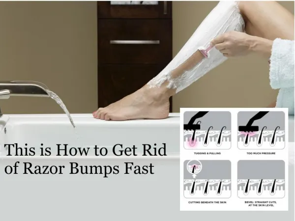 This is How to Get Rid of Razor Bumps Fast