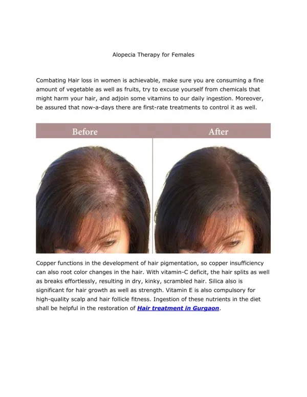 Alopecia Therapy for Females