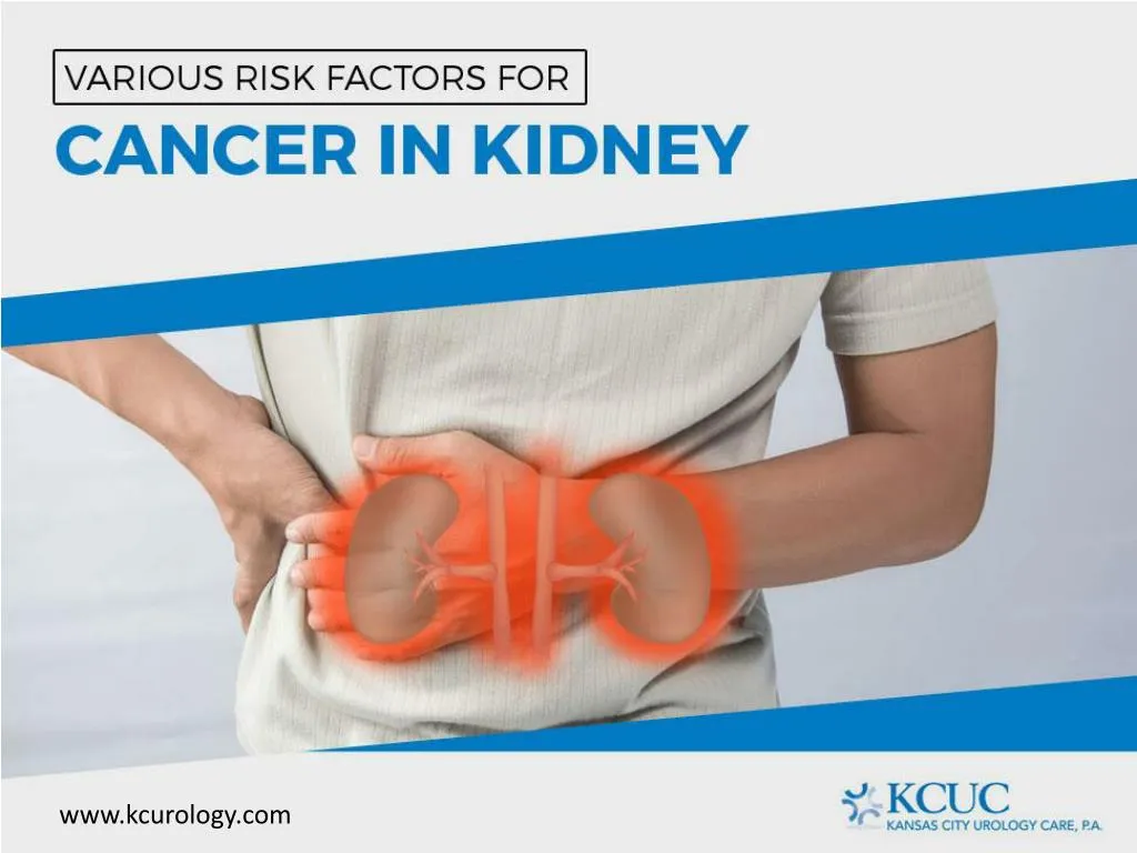 various risk factors for cancer in kidney
