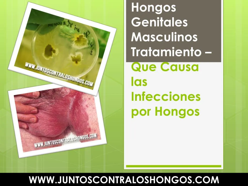 hongos genitales masculinos tratamiento que causa las infecciones por hongos
