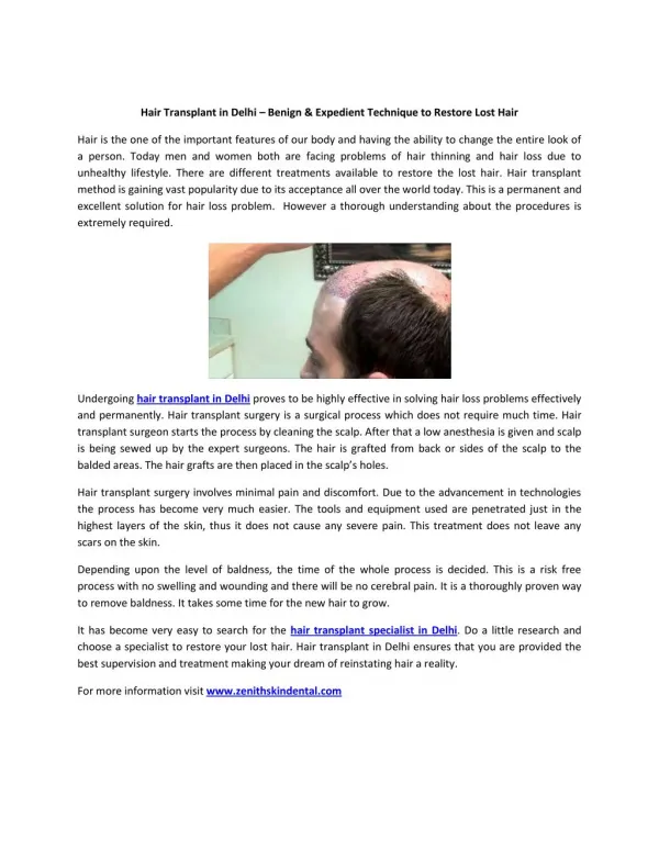 Hair Transplant in Delhi – Benign & Expedient Technique to Restore Lost Hair