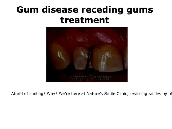 Receding gums cure