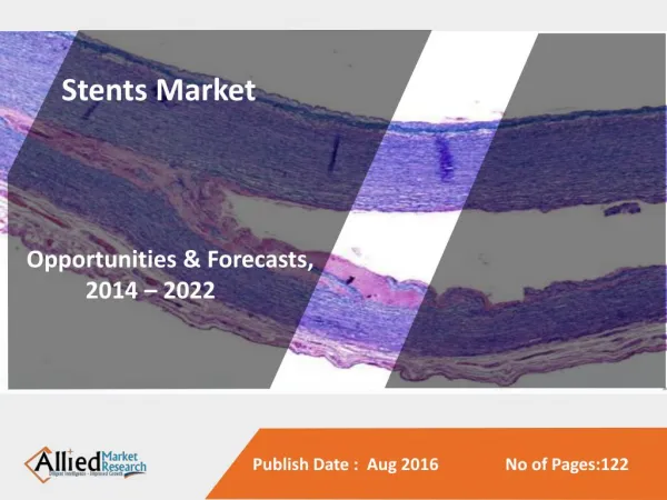 Stents Market to Reach $16,666 Million, Globally, by 2022