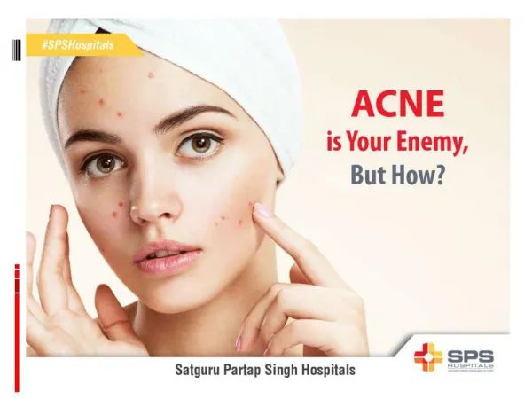 Acne is Your Enemy, But How?