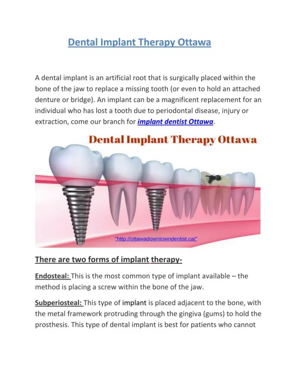 Dental Implant Therapy Ottawa