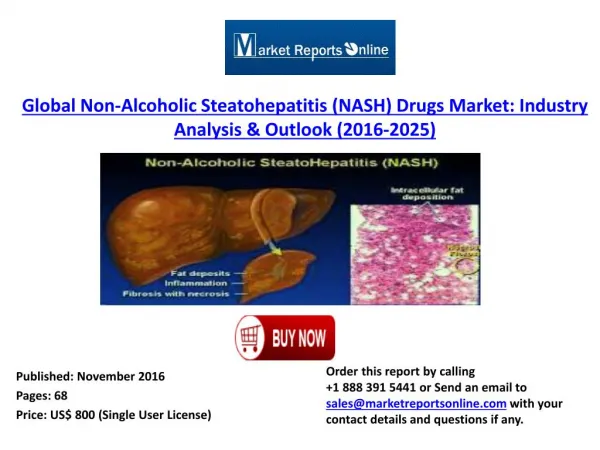 Global NASH Drugs Market 2016 Edition Report