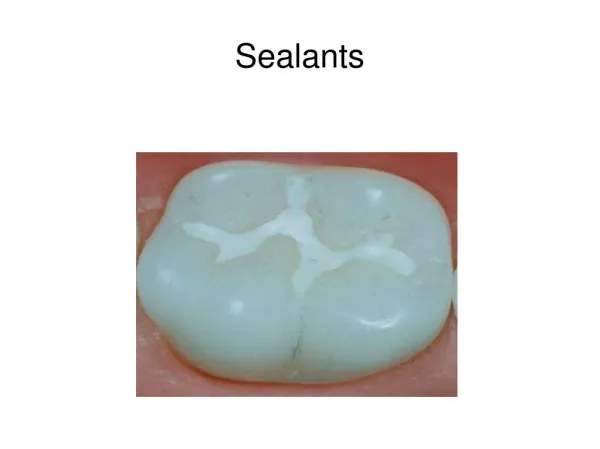 Sealants-Winnfamilydentistry