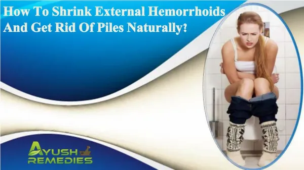 How To Shrink External Hemorrhoids And Get Rid Of Piles Naturally?