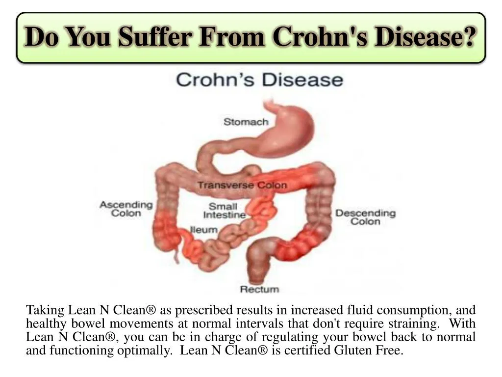 do you suffer from crohn s disease