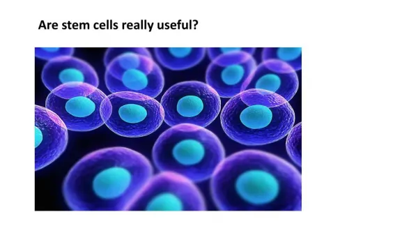 Are stemcells really useful
