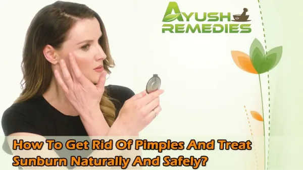 How To Get Rid Of Pimples And Treat Sunburn Naturally And Safely?