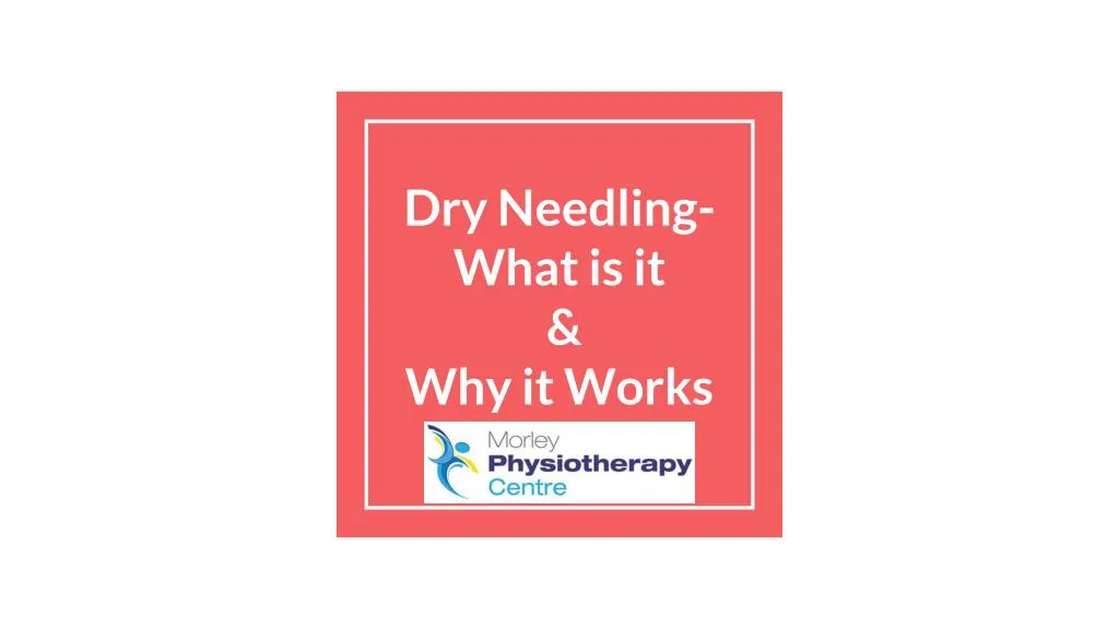 dry needling what is it why it works