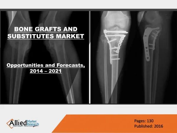 Global Bone Grafts And Substitutes Market Size 2022