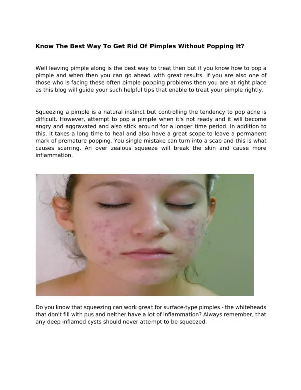 Know The Best Way To Get Rid Of Pimples Without Popping It?