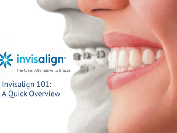 Invisalign 101: A Quick Overview from Orthodontics Limited