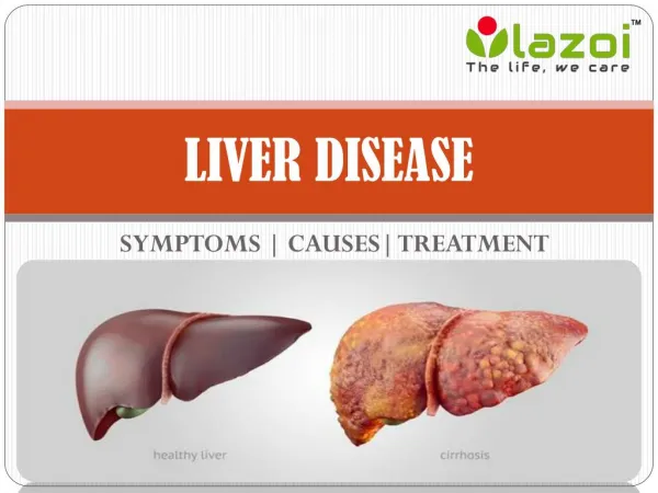 Liver Disease: Symptoms, causes, treatment, prevention and more