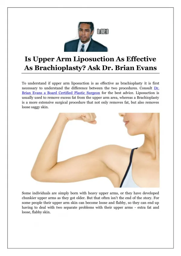 Is Upper Arm Liposuction As Effective As Brachioplasty? Ask Dr. Brian Evans
