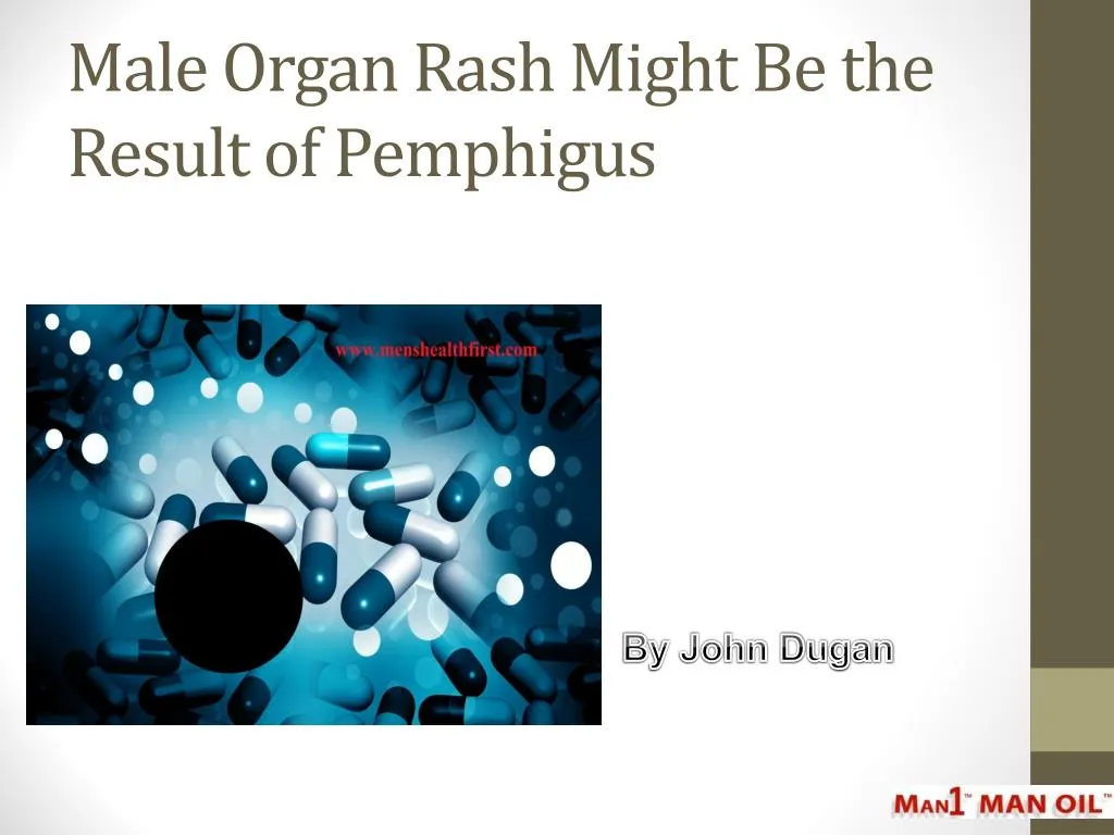 male organ rash might be the result of pemphigus