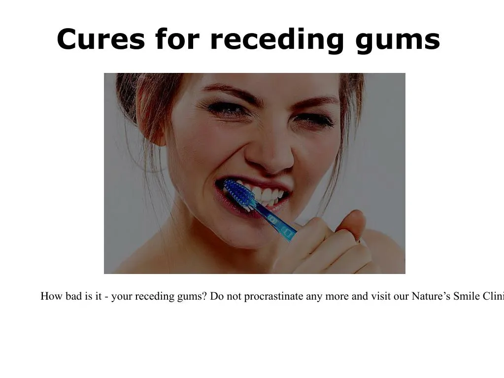 cures for receding gums