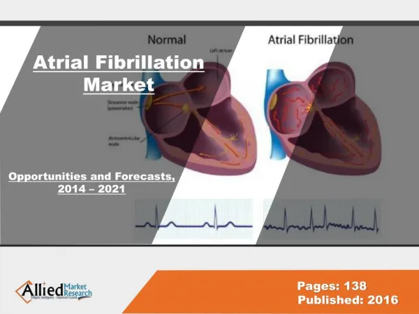 Atrial Fibrillation Ablation Market Size 2022
