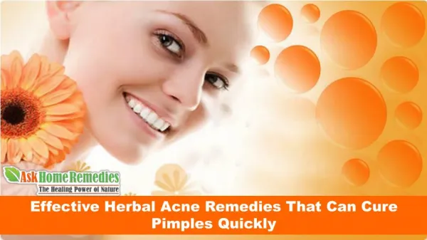 Effective Herbal Acne Remedies That Can Cure Pimples Quickly