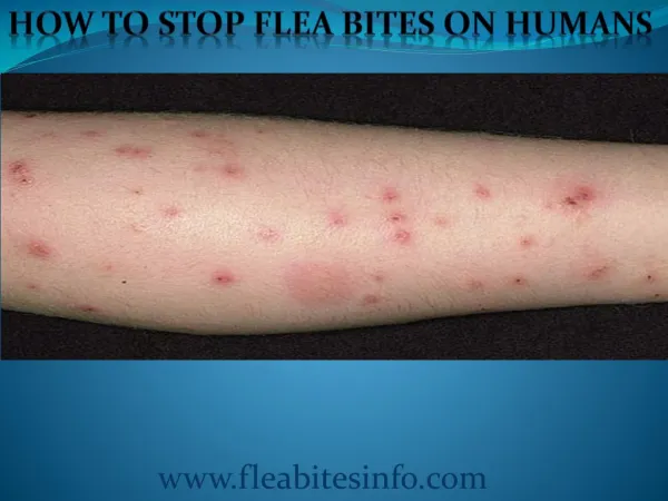 Flea bites-indication,Infestation treatment