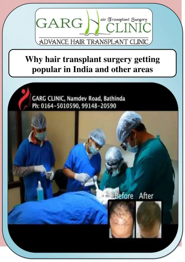 Why hair transplant surgery getting popular in India and other areas