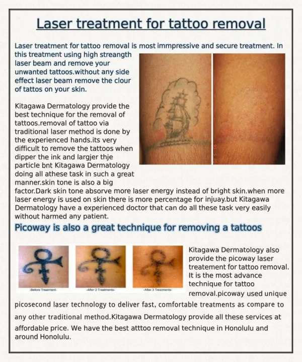 Laser treatement for tattoo removal