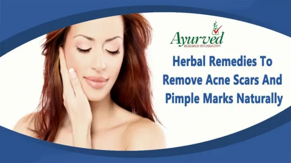 Herbal Remedies To Remove Acne Scars And Pimple Marks Naturally