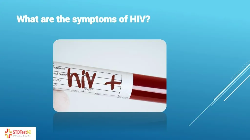 what are the symptoms of hiv