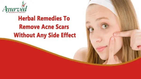 Herbal Remedies To Remove Acne Scars Without Any Side Effect