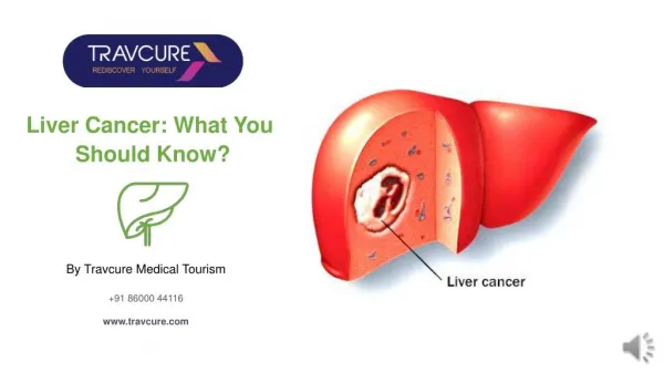 Liver Cancer: What You Should Know