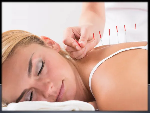 Acupuncture Treatment Improve the Body Functions